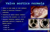 7-Valvulopatii Aortice Presented