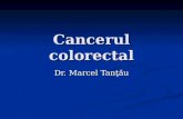 Cancerul colorectal