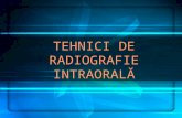 04a Tehnici radiografie intraorala v2a