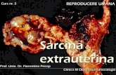 Curs 5 - Sarcina Extrauterina