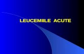 Curs 6. Leucemii Acute