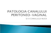 Patologia Canal Peritoneovaginal