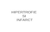 Hipertrofie Si Infarct
