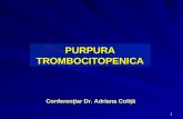Purpura trombocitopenica