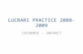 Ischemie - Infarct