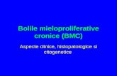 2. Bolile mieloproliferative cronice