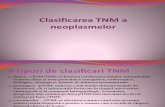 Clasificarea TNM a Neoplasmelor