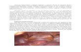 Anatomia Laparoscopica a Regiunii Inghinale e Oarecum Diferita de Anatomia Clasica