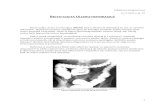 Rectocolita Ulcerohemoragica II