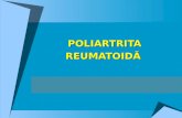 Poliartrita reumatoida[1]