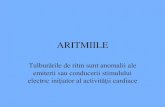 Aritmii- 30.03.2012