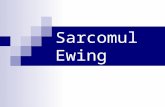 Sarcomul Ewing