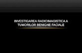 Curs 7 - Investigarea Radioimagistica a Tumorilor Benigne Faciale