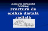 207918432 Fractura de Epifiză Distală Radială