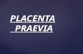 Obstetrica.placenta Praevia.