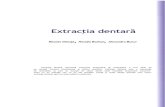 Extractia Dentara HD
