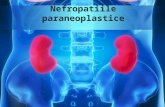 Nefropatiile paraneoplastice