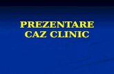 Caz Clinic HDS Varice