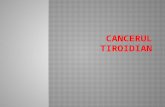cancerul tiroidiana