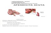 apendicita acuta