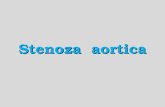CURS Stenoza Aortica 2012 Scribd