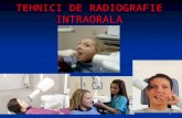 Tehnici de Radiografie Intraoral-â CURS 4