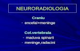 Neuro curs fundeni