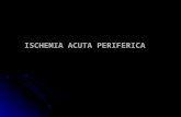 Ischemia Acuta Periferica