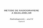 147968832 METODE de RADIOGRAFIERE a MAXILARELOR Curs Radiodiagnostic Medicina Dentara