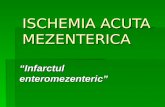 Ischemia Acuta Mezenterica