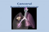 Cancerul Bronhopulmonar Si Esof