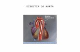 Disectia de Aorta