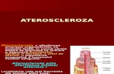 Ateroscleroza Hta Insuf Card