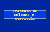 Fract cervicale
