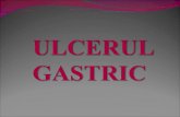 Ulcer Gastric Ff1[1]