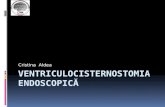 Ventriculocisternostomia  Endoscopic ă