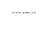 Aritmiile ventriculare