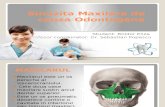 Sinuzita Maxilara de Cauza Odontogena