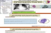 Neumonia Por Pneumocystis Jiirovecii en VIH