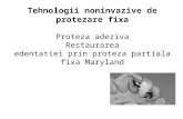 Tehnologii Noninvazive de Protezare Fixa