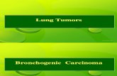 CURS NUMAI-Tumori Pulmonare Curs 2h