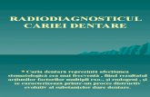 radio diagnosticul cariei dentare