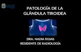 Patología de la glándula tiroidea en ecografia