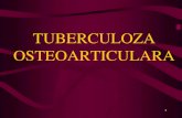 TUBERCULOZA OSTEOARTICULARA - justmed.eu1.pdf · frecventa dupa tbc pulmonar • este data de bacilul koch uman • se poate localiza la nivelul osului sau sinovialei articulare.