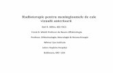 Radioterapie pentru meningioamele de cale vizuală anterioară · Trunchi cerebral