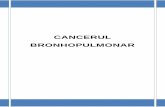 CANCERUL BRONHOPULMONAR - srp.ro BRONHOPULMONAR... · 2 cuprins cancerul bronhopulmonar 3 etiologie 4 anatomopatologie 5 tablou clinic 10 investigaŢii paraclinice 13 forme anatomo-clinice