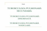 TUBERCULOZA PULMONARĂ SECUNDARĂ - …pneumoftiziologie.usmf.md/wp-content/blogs.dir/73/files/sites/73/... · se instalează sindromul bronho-pulmonar, apar manifestări laringiene