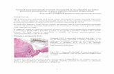 Tumoră gastrointestinală stromală descoperită la ...cercetaremedicala.ro/bnc/images/docs/4564544.pdf · Fiind o patologie relativ recentdescoperită, epidemiologia GIST este slab