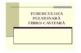 TUBERCULOZA PULMONARĂ FIBRO-CAVITARĂ · Disectia acuta de aorta Alte patologii Pleurezia Pneumonia Angina pectorala Boala ulceroasa Pancreatita acuta Colecistita acuta. Tratament