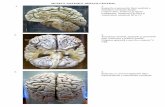 MUZEUL SISTEMUL SNC - anatomiaomului.usmf.md · precum și originea aparentă a nervilor cranieni III și V. 20. 35. Ventriculele laterale ale creierului. Sunt demonstrate toate compartimentele